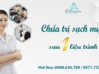 Top 3 Spa trị mụn hiệu quả nhất quận Long Biên, Hà Nội
