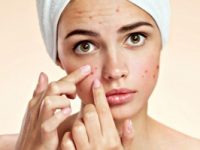 Top 4 Spa trị mụn hiệu quả nhất TP. Bà Rịa